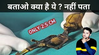 Interesting Fact About Skeleton   | FactTechz New Video | facttechz horror video | #Shorts