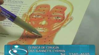 Tratamiento con botox para las arrugas en la cara