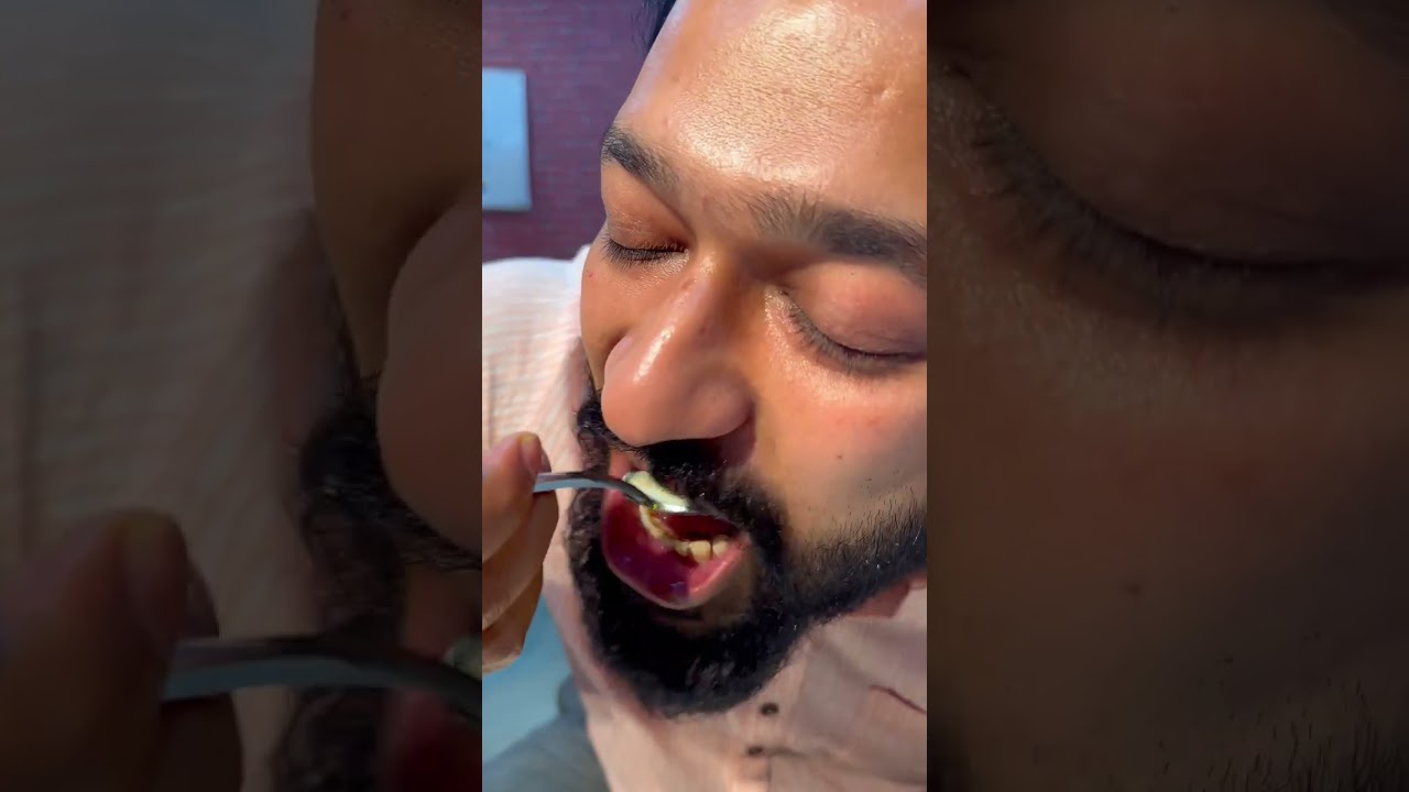 Лучший бангальский буфет в Калькутте, предлагающий около 25 различных блюд, включая курицу, баран...