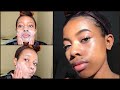 Bye Bye Acne Scars and Pimples 👋 | My Skincare Routine 2019 🌟