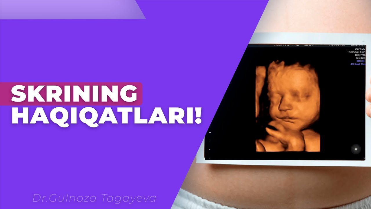 1-skriningda nimalar ko‘riladi? Qanday analizlar topshirish kerak homiladorlar uchun tavsiyalar!