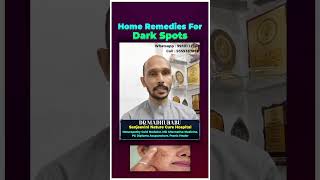 Home Remedies For Dark Spots