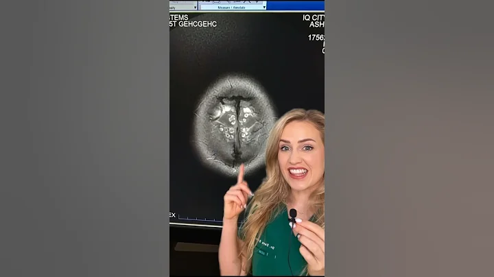 You won’t believe what’s in this brain!