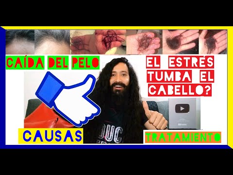 Video: Calvicie Por Estrés Habitual. Depresión Y Alopecia Enmascaradas