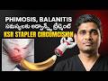 ఫోర్ స్కిన్ సమస్యలకు ట్రీట్మెంట్ | KSR Stapler Circumcision for Balanitis | Treatment Range Hospital