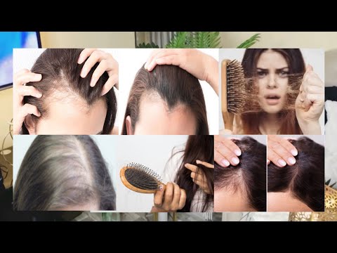 Challenge Timaha Part 8 Timaha Wajiga Hore Gadal U Ga Siktay Sida Lo So Celiyo Io Sababta Kento