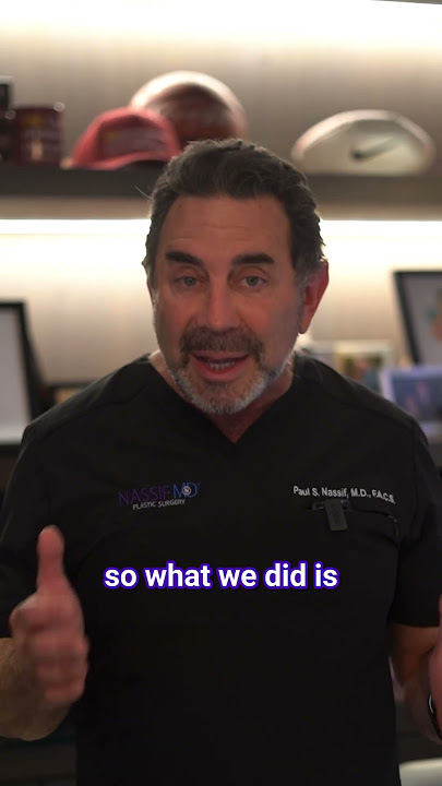 Expert Revision Rhinoplasty with Dr. Paul Nassif: Using Rib for Optimal Results!