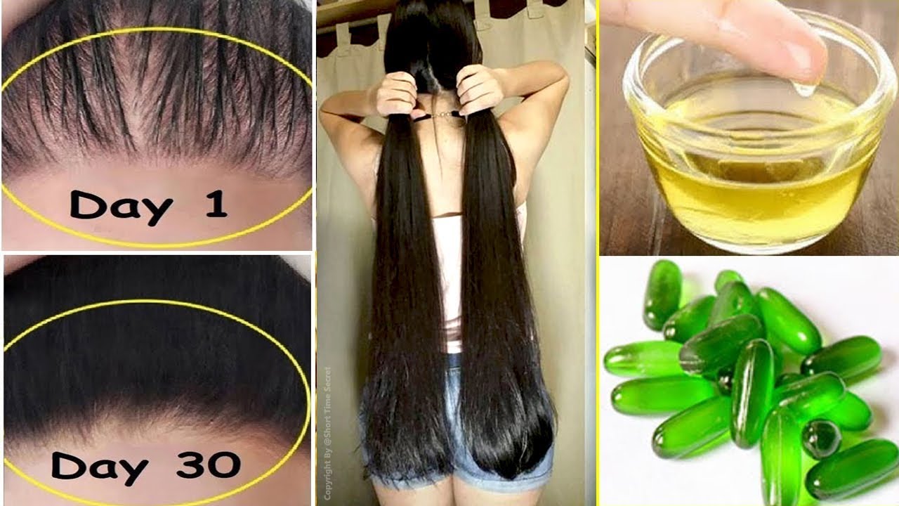 Vitamin E Hair Food - wide 8