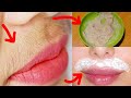 होठों के ऊपर के बाल Upper Lips Hair एक बार हटाने के बाद वापस कभी नहीं आएंगे | Facial Hair Treatment