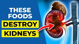 7 Foods that Destroy Kidneys & Block Arteries by Heart Disease Code 49,863 views 6 months ago 15 minutes
