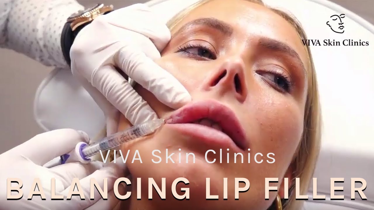 Balancing Uneven Lips With Filler Adding Lip Volume Viva Skin