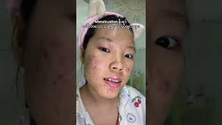 My friends appear when it’s menstruation time #periodfeatures #menstration #acne #shorts