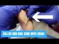 CALLUS AND NAIL CARE WITH CHAD!