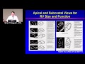 Assessment of RV Function (Sherif Nagueh, MD) February 14, 2017