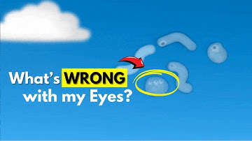 What are those floating things in your eyes? | Eye Floaters Explained