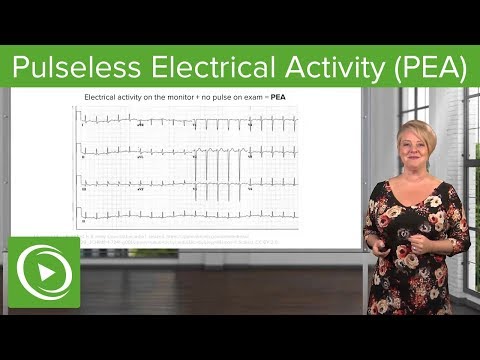 Pulseless Electrical Activity (PEA) – Emergency Medicine | Lecturio