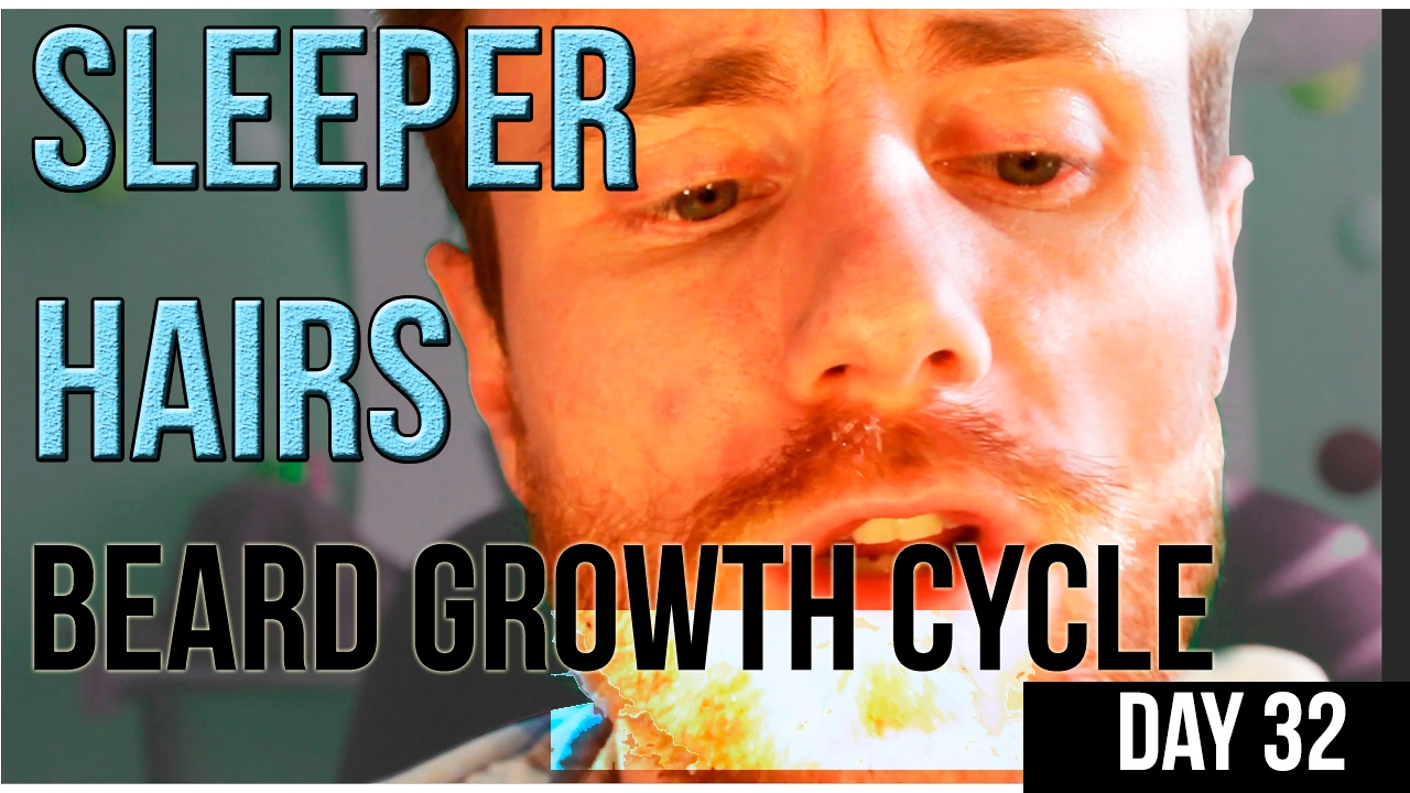 Sleeper Hairs & How they will IMPROVE your Beard GAME! Hair Growth Cycle :  Thin, Patchy Advice - YouTube