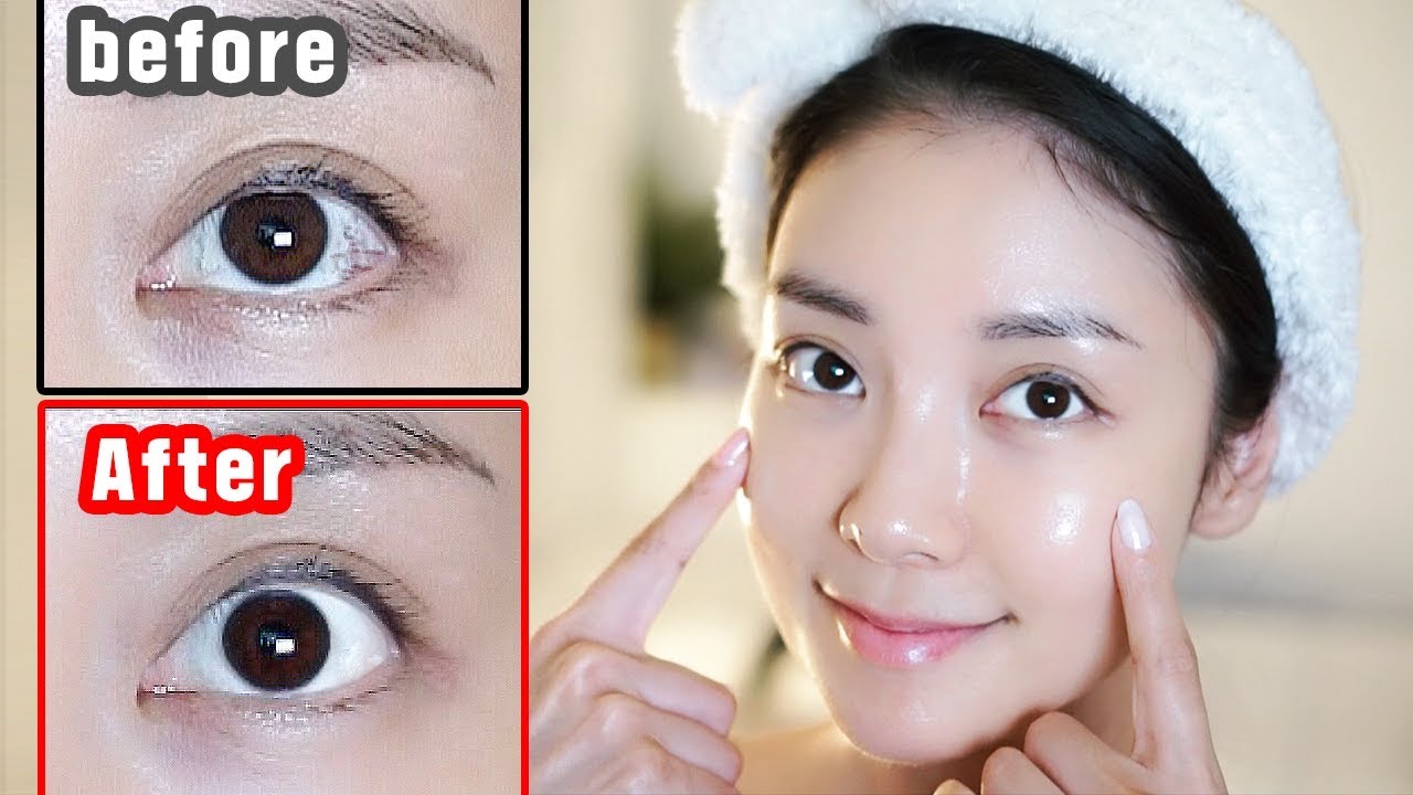 ENG) 깨끗한 흰자 만드는 법! 실핏줄, 탁한, 지저분한 흰자 해결! How to clear up the white of the eye   | 뷰티클라우드 유나 UNA