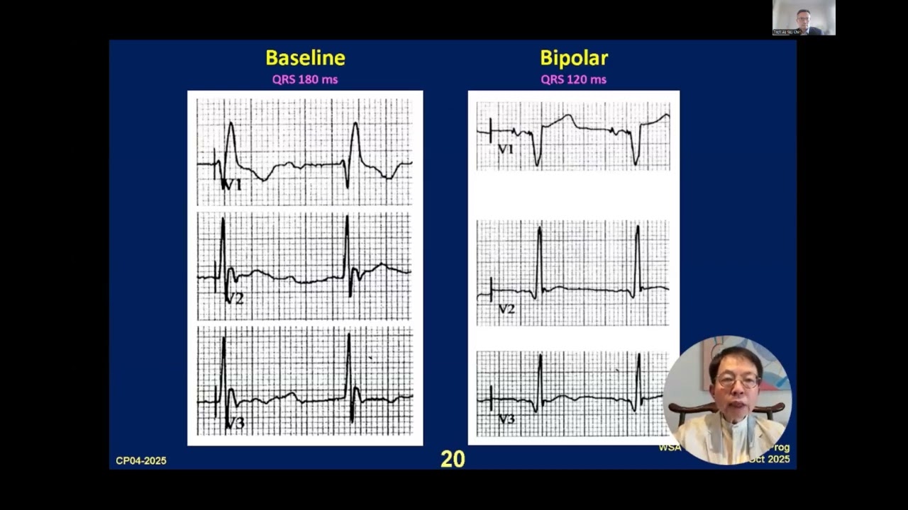 WORLD SOCIETY OF ARRHYTHMIAS(WSA)BRADYCARDIA EDUCATIONAL PROGRAM SERIES Patient and Device Selection