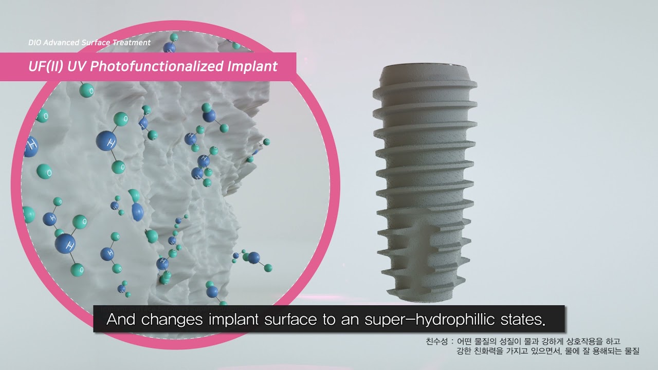 DIO UV ACTIVE IMPLANT SYSTEM