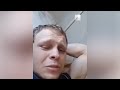 Избитый парень записал видео и впал в кому