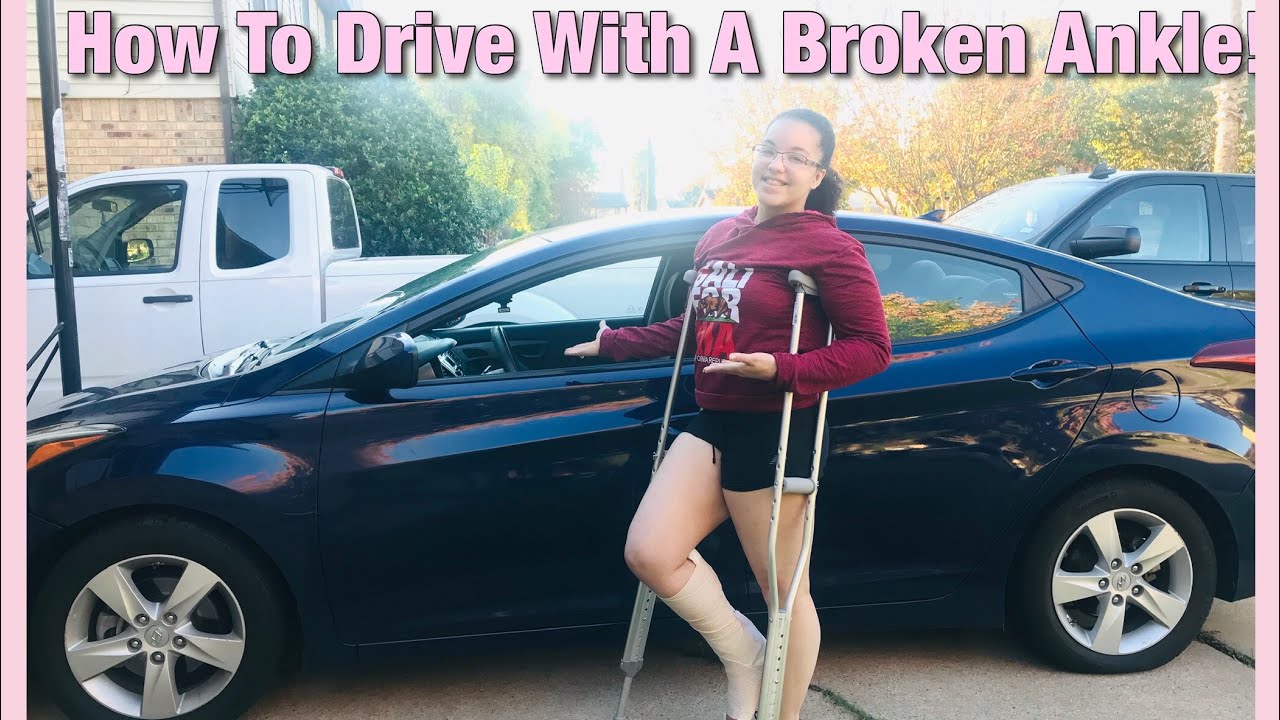 How to drive with a BROKEN ANKLE! YouTube