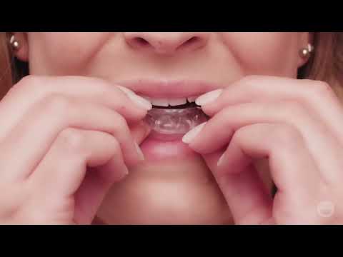 Cookstown Dental Centre Clear Aligners Invisalign Testimonial