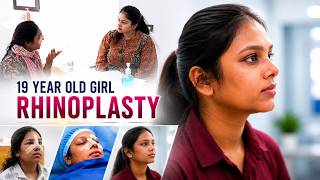 19 Year Old Girl’s Rhinoplasty Journey | Before & After Results