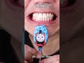 Satisfying Chewing ASMR #Compilation #ASMR #DoctorTristanPeh