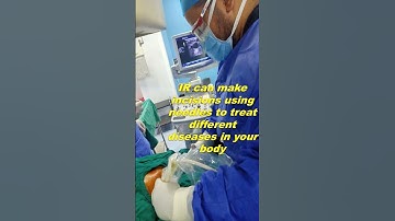 Interventional radiologist importance #shorts #usa #radiologist #interventionalradiology #radiology