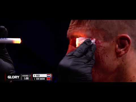 ?Rico suffers HUGE cut under the eye during glory collision 3 #shorts #glory