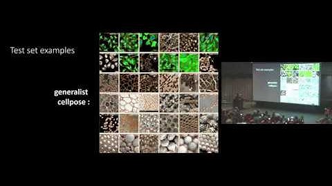 Cellpose: a generalist algorithm for cellular segmentation