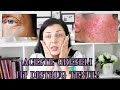 GRESELI DE SKINCARE PE CARE LE FACI SI CARE ITI DISTRUG TENUL | Skincare ABC #3