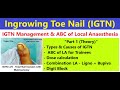 How to give local anesthesia digit block ingrown toenail igtn management 13 ingrowingnail