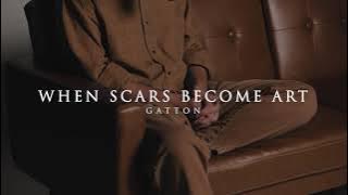 When Scars Become Art (Acoustic) - Gatton