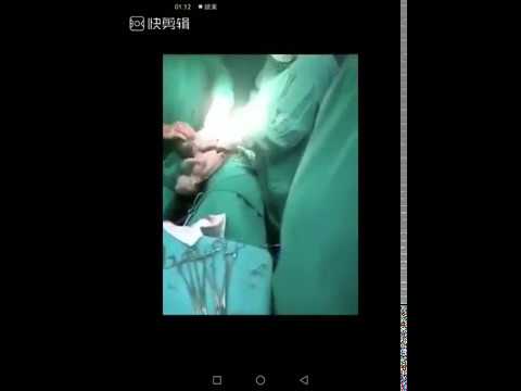 一次17個人