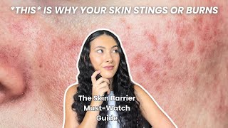 Signs of Damaged Skin Barrier You