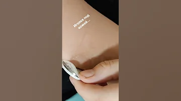 Вытаскиваю иголку из кожи 👻