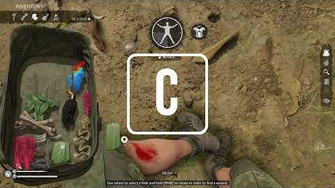 Green Hell [Switch/PS4/XOne/PC] Tutorial #02: Wounds & Bandages