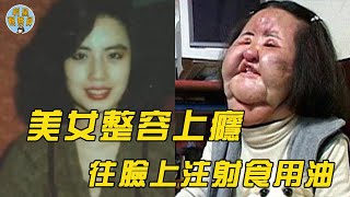 韓國女星整容上癮，花百萬將自己整成怪物，連父母看到都害怕 ｜整容｜明星觀察員