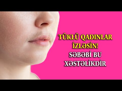 Video: Qadın üz tüklərindən qurtulmağın 4 yolu