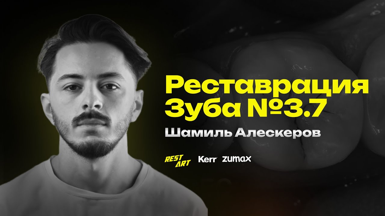 Реставрация зуба №3.7 | Полный протокол | Шамиль Алескеров | RestArt | Zumax