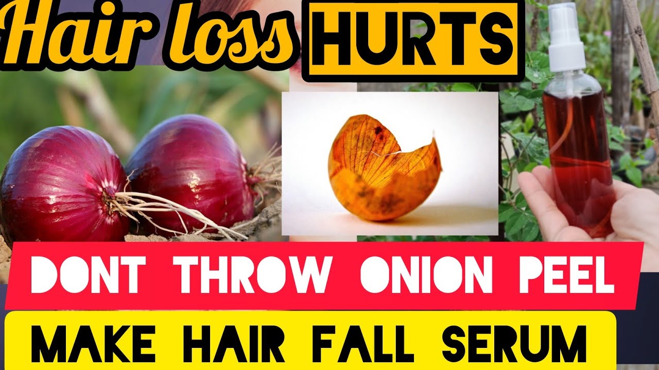 Hair Care Tips To Stem Hair Loss; HOW to Make Hair Fall Serum at Home With  Onion Peel - YouTube