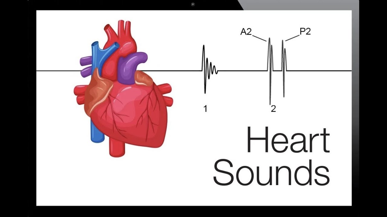 🩺 heart sounds and murmurs  شرح