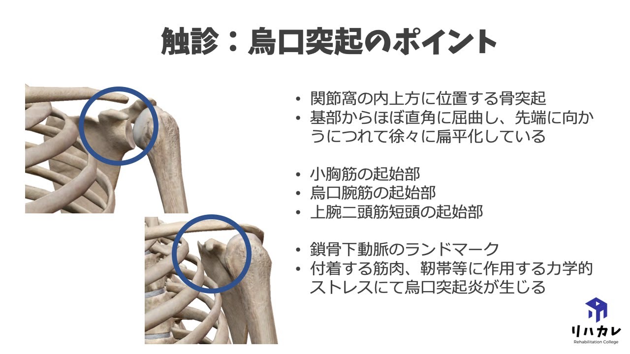 烏口突起の触診のコツ[骨の触診] - YouTube