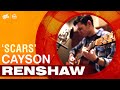Cayson Renshaw 'Scars' - LIVE on Jam Chats