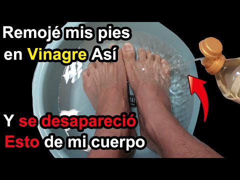 REMOJA tus pies ASÍ en vinagre Verás que se desaparecen estas cosas de tu cuerpo