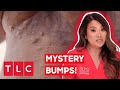 Dr. Lee Pops DOZENS Of Mysterious Bumps! | Dr Pimple Popper: With Every Cyst-mas Card I Write