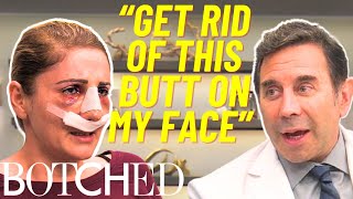 Dr. Nassif Attempts To Fix Rose's 'Butt Nose' After Two Failed Surgeries | Botched | E! Profile
