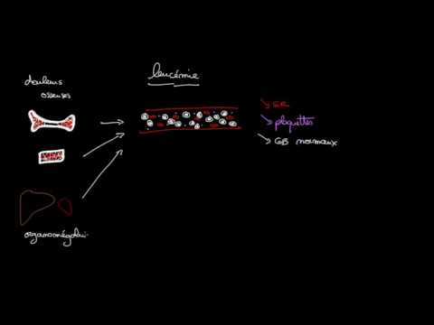 Vidéo: Qu'est-ce Que La Leucémie Myéloïde Chronique?